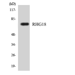 Western blot of the lysates from HepG2 cells using RHG18 antibody.