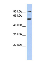 ACAP3 / CENTB5 antibody LS-C111395 Western blot of Fetal Pancreas lysate.