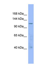 ARHGAP20 antibody LS-C117275 Western blot of 721_B cell lysate.