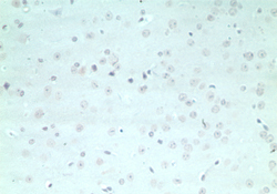 IHC of mouse brain using control (rabbit Ig) at 5 ug/ml.