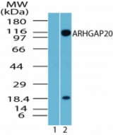 Western blot of ARHGAP20 in rat brain lysate. Lane 1 shows pre-immune sera. Lane 2 shows antibody tested at 8 ug/ml.