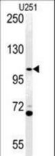 Western blot of ACAP3 Antibody in U251 cell line lysates (35 ug/lane). ACAP3 (arrow) was detected using the purified antibody.