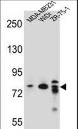 ARHGAP22 Antibody western blot of MDA-MB231,WiDr,ZR-75-1 cell line lysates (35 ug/lane). The ARHGAP22 antibody detected the ARHGAP22 protein (arrow).