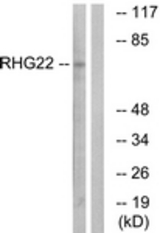 Western blot of extracts from K562 cells, using RHG22 Antibody. The lane on the right is treated with the synthesized peptide.
