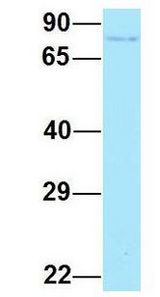 ARHGAP22 / RhoGAP2 antibody Western Blot of Human Fetal Lung. Antibody Dilution: 1.0ug/ml. Antibody dilution: 1 ug/ml.