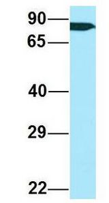 ARHGAP22 / RhoGAP2 antibody Western Blot of Human 721_B lysate. Antibody Dilution: 1.0 ug/ml. ARHGAP22 is supported by BioGPS gene expression data to be expressed in 721_B. Antibody dilution: 1 ug/ml.