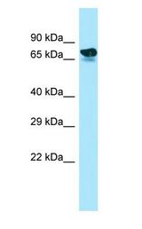 ARHGAP22 / RhoGAP2 antibody Western Blot of Fetal Kidney.