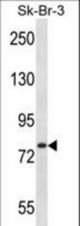 ARHGAP24 Antibody western blot of SK-BR-3 cell line lysates (35 ug/lane). The ARHGAP24 antibody detected the ARHGAP24 protein (arrow).