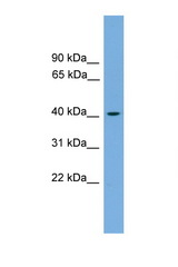 ACAT1 antibody LS-C116567 Western blot of HepG2 Cell lysate. Antibody concentration 1 ug/ml.