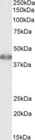 ACAT1 antibody (0.01 ug/ml) staining of Human Liver lysate (35 ug protein/ml in RIPA buffer). Primary incubation was 1 hour. Detected by chemiluminescence.