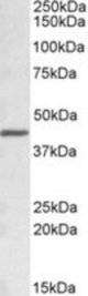 ACAT1 antibody (0.1 ug/ml) staining of Mouse Liver lysate (35 ug protein in RIPA buffer). Primary incubation was 1 hour. Detected by chemiluminescence.