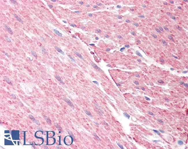Anti-ARHGAP26 / GRAF antibody IHC staining of human colon, muscularis propria. Immunohistochemistry of formalin-fixed, paraffin-embedded tissue after heat-induced antigen retrieval.
