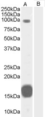 Antibody (0.3 ug/ml) staining of Human Heart lysate (35 ug protein in RIPA buffer) with (B) and without (A) blocking with the immunizing peptide. Primary incubation was 1 hour. Detected by chemiluminescence.