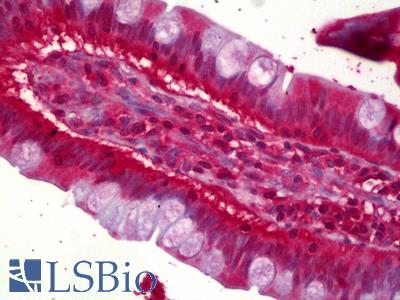 Anti-ACAT1 antibody IHC of human small intestine. Immunohistochemistry of formalin-fixed, paraffin-embedded tissue after heat-induced antigen retrieval. Antibody LS-B6369 concentration 2 ug/ml.