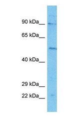 Western blot of RHG27 Antibody with human HepG2 Whole Cell lysate.