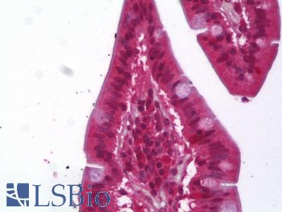 Anti-ACAT1 antibody IHC of human small intestine. Immunohistochemistry of formalin-fixed, paraffin-embedded tissue after heat-induced antigen retrieval. Antibody LS-B6372 concentration 2.5 ug/ml.