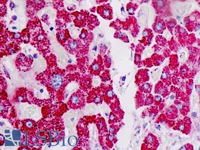 Anti-ACAT1 antibody IHC staining of human liver. Immunohistochemistry of formalin-fixed, paraffin-embedded tissue after heat-induced antigen retrieval.