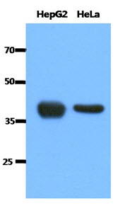 Western Blot: The cell lysates (40 ug) were resolved by SDS-PAGE, transferred to PVDF membrane and probed with anti-human ACAT1 antibody (1:1000). Proteins were visualized using a goat anti-mouse secondary antibody conjugated to HRP and an ECL detection system.