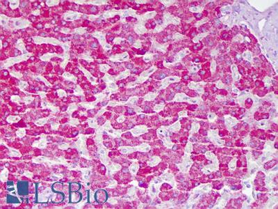 Anti-ACAT1 antibody IHC of human liver, hepatocytes. Immunohistochemistry of formalin-fixed, paraffin-embedded tissue after heat-induced antigen retrieval. Antibody LS-B6286 concentration 5 ug/ml.