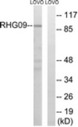 Western blot of extracts from LOVO cells, using RHG9 Antibody. The lane on the right is treated with the synthesized peptide.