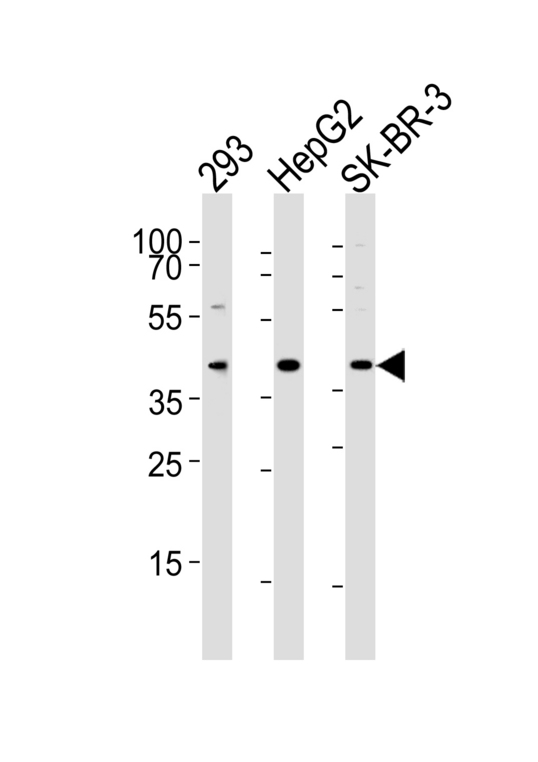 Western blot of lysates from 293, HepG2, SK-BR-3 cell line (from left to right) with ACAT1 Antibody. Antibody was diluted at 1:1000 at each lane. A goat anti-rabbit IgG H&L (HRP) at 1:5000 dilution was used as the secondary antibody. Lysates at 35 ug per lane.