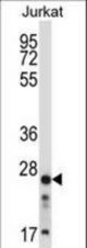 ARHGDIB Antibody western blot of Jurkat cell line lysates (35 ug/lane). The ARHGDIB antibody detected the ARHGDIB protein (arrow).