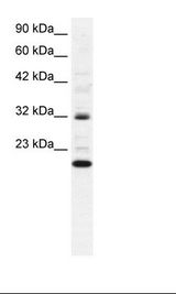 Daudi Cell Lysate