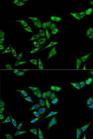 Immunofluorescence analysis of A549 cell using ACAT1 antibody. Blue: DAPI for nuclear staining.