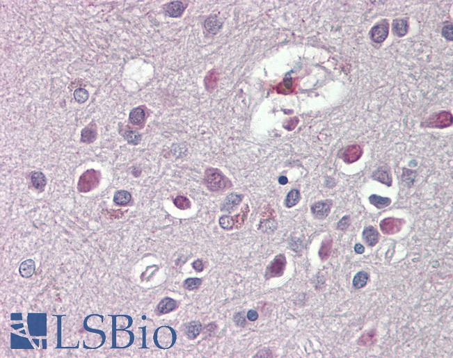 Anti-ARHGDIG / RHOGDI-3 antibody IHC of human brain, cortex. Immunohistochemistry of formalin-fixed, paraffin-embedded tissue after heat-induced antigen retrieval. Antibody LS-B8339 dilution 3.75 ug/ml.