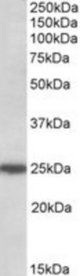 ARHGDIG antibody (0.5 ug/ml) staining of HeLa lysate (35 ug protein/ml in RIPA buffer). Primary incubation was 1 hour. Detected by chemiluminescence.