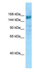 ARHGEF10 / GEF10 antibody Western Blot of ACHN.