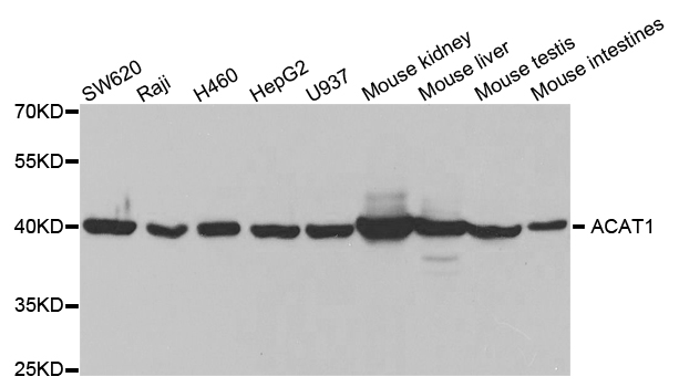 Western blot analysis of extracts of various cell lines, using ACAT1 antibody.
