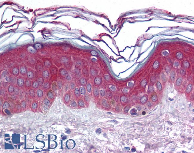 Anti-ARHGEF11 antibody IHC of human skin. Immunohistochemistry of formalin-fixed, paraffin-embedded tissue after heat-induced antigen retrieval. Antibody LS-B1801 concentration 10 ug/ml.
