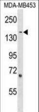 ARHGEF11 Antibody western blot of MDA-MB453 cell line lysates (35 ug/lane). The ARHGEF11 antibody detected the ARHGEF11 protein (arrow).