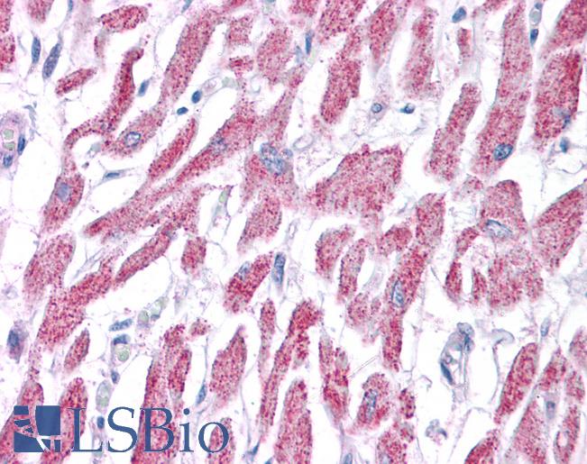 Anti-ACAT1 antibody IHC of human heart. Immunohistochemistry of formalin-fixed, paraffin-embedded tissue after heat-induced antigen retrieval. Antibody LS-B4679 concentration 5 ug/ml.