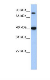 Fetal heart lysate. Antibody concentration: 1.0 ug/ml. Gel concentration: 12%.