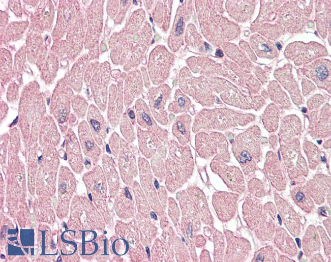 Anti-ARHGEF17 / TEM4 antibody IHC of human heart. Immunohistochemistry of formalin-fixed, paraffin-embedded tissue after heat-induced antigen retrieval. Antibody LS-B3213 concentration 5 ug/ml.