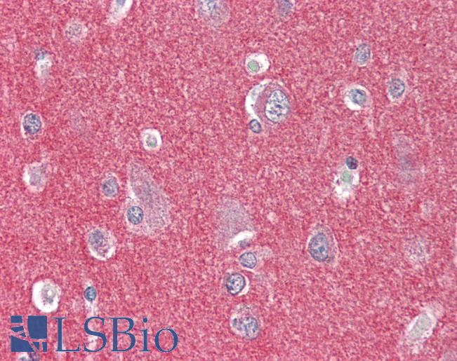 Anti-ARHGEF17 / TEM4 antibody IHC of human brain, cortex. Immunohistochemistry of formalin-fixed, paraffin-embedded tissue after heat-induced antigen retrieval. Antibody LS-B3213 concentration 5 ug/ml.