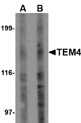 Western blot of TEM4 in Jurkat Cell lysate with TEM4 antibody at (A) 1 and (B) 2 ug/ml. Below: Immunohistochemistry of TEM4 in human spleen tissue with TEM4 antibody at 2.5 ug/ml.