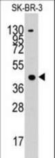 Western blot of anti-ACAT1 antibody in SK-BR-3 cell line lysates (35 ug/lane). ACAT1 (arrow) was detected using the purified antibody.