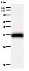 Western blot of immunized recombinant protein using ARID1A antibody.