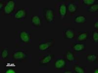 Immunostaining analysis in HeLa cells. HeLa cells were fixed with 4% paraformaldehyde and permeabilized with 0.1% Triton X-100 in PBS. The cells were immunostained with anti-ARID1A mAb.