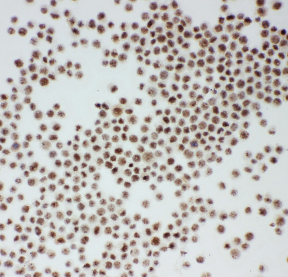 ARID1A / BAF250 antibody. ICC: K562 Cell.