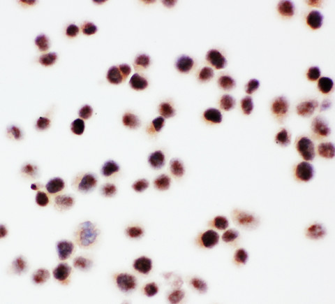ARID1A / BAF250 antibody. ICC: HELA Cell.