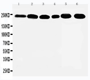 WB of ARID1A / BAF250 antibody. Lane 1: SKOV Cell Lysate. Lane 2: HELA Cell Lysate. Lane 3: JURKAT Cell Lysate. Lane 4: U937 Cell Lysate. Lane 5: Rat Thymus Tissue Lysate. Lane 6: Rat Liver Tissue Lysate.