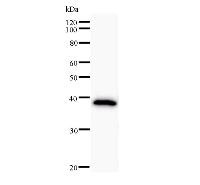 Western blot analysis of immunized recombinant protein, using anti-ARID2 monoclonal antibody.