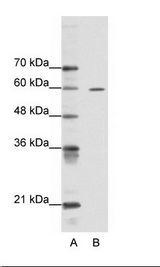 A: Marker, B: HepG2 Cell Lysate