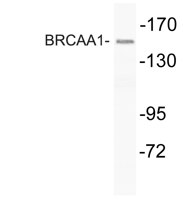 Western blot of BRCAA1 (D810) pAb in extracts from HUVEC cells.