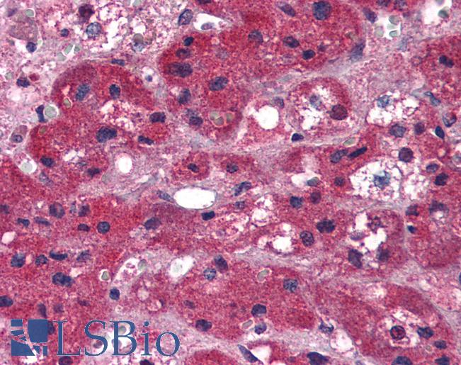 Anti-ARIH1 antibody IHC of human adrenal. Immunohistochemistry of formalin-fixed, paraffin-embedded tissue after heat-induced antigen retrieval. Antibody LS-B2620 concentration 5 ug/ml.