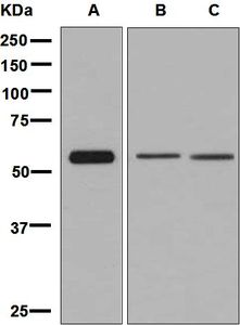 Western blot analysis on (A) Jurkat, (B) K562, and (C) 293T cell lysates using anti-ARIH2 antibody.